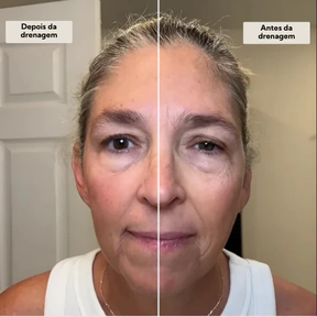 DrenaFace - Escova de Drenagem Linfática Facial - Escova Coreana
