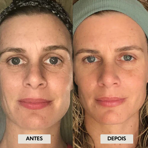 DrenaFace - Escova de Drenagem Linfática Facial - Escova Coreana