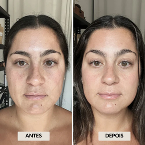 DrenaFace - Escova de Drenagem Linfática Facial - Escova Coreana