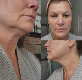 DrenaFace - Escova de Drenagem Linfática Facial - Escova Coreana