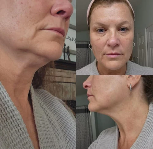 DrenaFace - Escova de Drenagem Linfática Facial - Escova Coreana